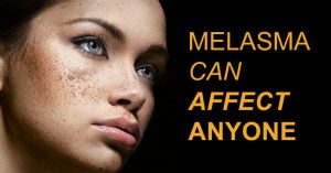 cure melasma from the inside